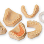 6 different types of dentures
