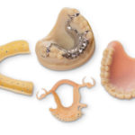 4 different types of dental models