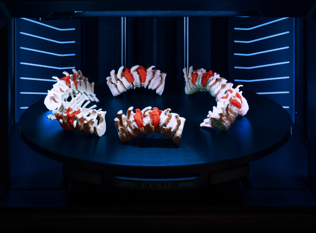 Spine Models on Round Tray